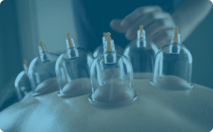 Баночный массаж